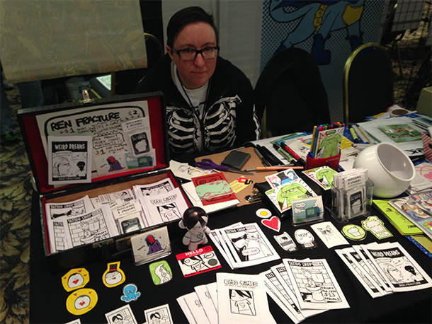 Ren Fracture Illustration